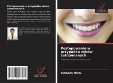 Buchcover von Postępowanie w przypadku zębów zatrzymanych