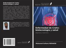 Portada del libro de Enfermedad de Crohn: biotecnología y salud
