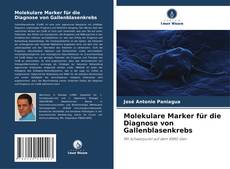 Bookcover of Molekulare Marker für die Diagnose von Gallenblasenkrebs