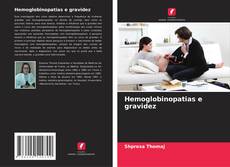 Borítókép a  Hemoglobinopatias e gravidez - hoz