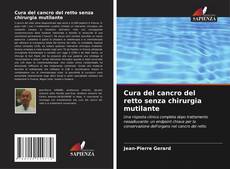 Bookcover of Cura del cancro del retto senza chirurgia mutilante