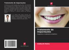 Capa do livro de Tratamento de impactações 