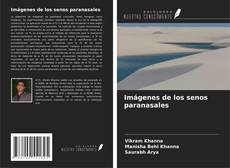 Buchcover von Imágenes de los senos paranasales