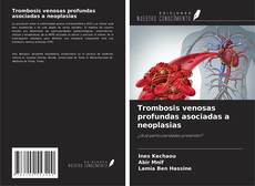 Copertina di Trombosis venosas profundas asociadas a neoplasias