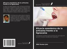 Copertina di Eficacia anestésica de la articaína frente a la lignocaína