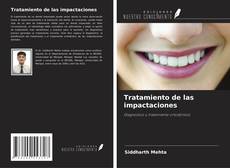 Buchcover von Tratamiento de las impactaciones