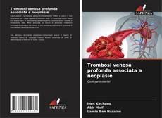 Capa do livro de Trombosi venosa profonda associata a neoplasie 