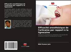 Couverture de Efficacité anesthésique de l'articaïne par rapport à la lignocaïne