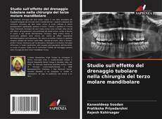 Borítókép a  Studio sull'effetto del drenaggio tubolare nella chirurgia del terzo molare mandibolare - hoz