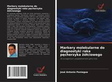 Couverture de Markery molekularne do diagnostyki raka pęcherzyka żółciowego