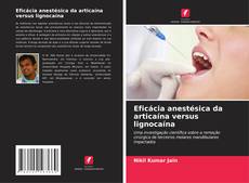 Buchcover von Eficácia anestésica da articaína versus lignocaína
