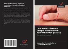 Buchcover von Cele molekularne w terapii nowotworów nabłonkowych grasicy