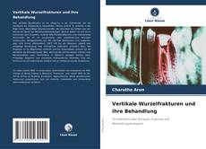 Обложка Vertikale Wurzelfrakturen und ihre Behandlung