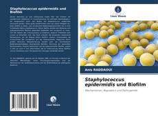 Обложка Staphylococcus epidermidis und Biofilm