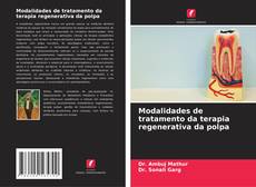 Modalidades de tratamento da terapia regenerativa da polpa的封面