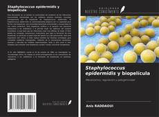 Buchcover von Staphylococcus epidermidis y biopelícula