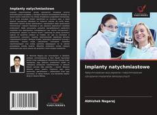 Bookcover of Implanty natychmiastowe