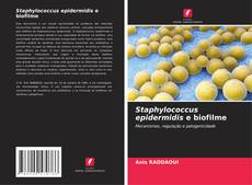 Staphylococcus epidermidis e biofilme的封面