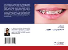 Portada del libro de Tooth Transposition