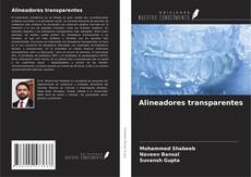 Borítókép a  Alineadores transparentes - hoz