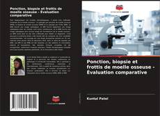 Couverture de Ponction, biopsie et frottis de moelle osseuse - Évaluation comparative