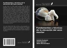 Copertina di Fundamentos y técnicas de la elevación del seno maxilar