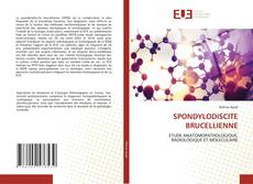 Portada del libro de SPONDYLODISCITE BRUCELLIENNE