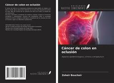 Copertina di Cáncer de colon en oclusión