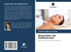 Copertina di Akupunktur bei Endometriose