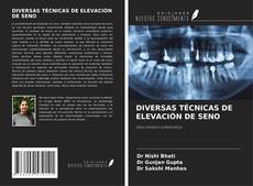 Buchcover von DIVERSAS TÉCNICAS DE ELEVACIÓN DE SENO