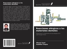 Buchcover von Reacciones alérgicas a los materiales dentales