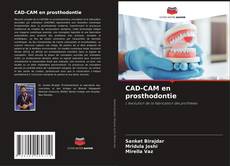 Couverture de CAD-CAM en prosthodontie