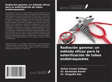 Buchcover von Radiación gamma: un método eficaz para la esterilización de tubos endotraqueales