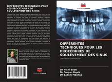 Couverture de DIFFÉRENTES TECHNIQUES POUR LES PROCÉDURES DE SOULÈVEMENT DES SINUS