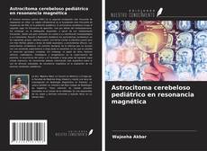 Capa do livro de Astrocitoma cerebeloso pediátrico en resonancia magnética 