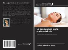Bookcover of La acupuntura en la endometriosis