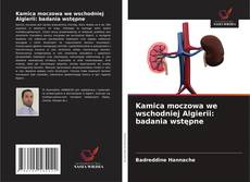 Buchcover von Kamica moczowa we wschodniej Algierii: badania wstępne