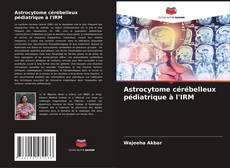 Обложка Astrocytome cérébelleux pédiatrique à l'IRM