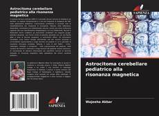 Обложка Astrocitoma cerebellare pediatrico alla risonanza magnetica