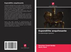 Borítókép a  Espondilite anquilosante - hoz