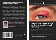 Couverture de Manual sobre cataratas y perfiles enzimáticos del cristalino