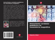Copertina di Astrocitoma cerebelar pediátrico na ressonância magnética