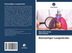 Bookcover of Kleinzelliger Lungenkrebs