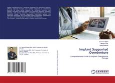Portada del libro de Implant Supported Overdenture