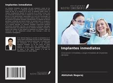 Copertina di Implantes inmediatos