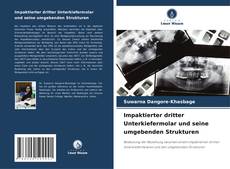 Buchcover von Impaktierter dritter Unterkiefermolar und seine umgebenden Strukturen