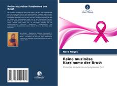 Couverture de Reine muzinöse Karzinome der Brust