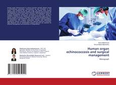 Human organ echinococcosis and surgical management kitap kapağı