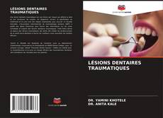 Bookcover of LÉSIONS DENTAIRES TRAUMATIQUES