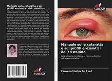 Couverture de Manuale sulla cataratta e sui profili enzimatici del cristallino